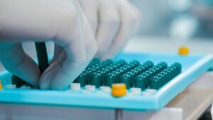 Rocket Pharmaceuticals Advances Danon Disease Gene Therapy Trial With FDA Alignment